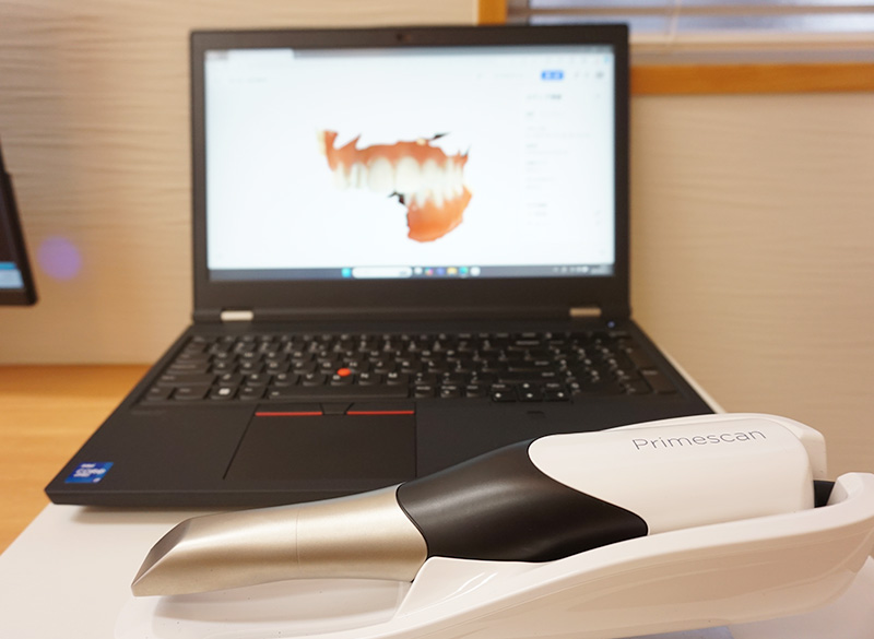 口腔内スキャナー